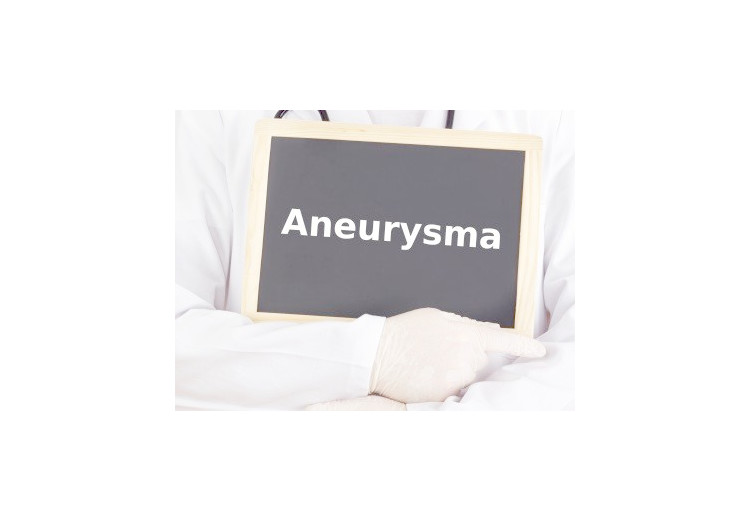 Aneuryzma: delenie, diagnostika, rizikové faktory a liečba