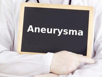Aneuryzma: delenie, diagnostika, rizikové faktory a liečba