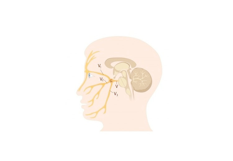 Neuralgia trojklanného nervu: príčiny, príznaky, diagnostika a liečba