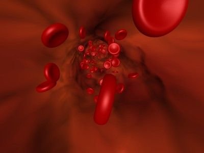 Kongenitální hypoplastická anemie: příčiny, příznaky, diagnostika a léčba