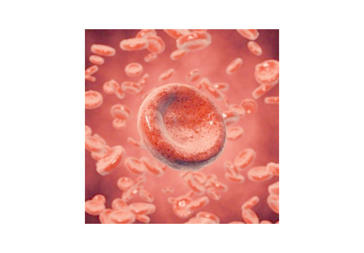 Trombotická trombocytopenická purpura: příčiny, příznaky, diagnostika a léčba