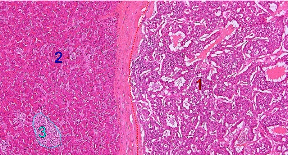 Pathology Case Study 1