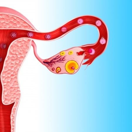 Ovariální hyperstimulační syndrom: příčiny, příznaky, diagnostika a léčba