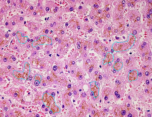 Histopathology Quiz Picture 1