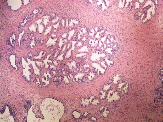 Histopathology quiz 3