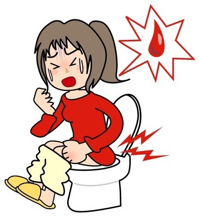 Hemorrhoids: causes, symptoms, treatment and complications