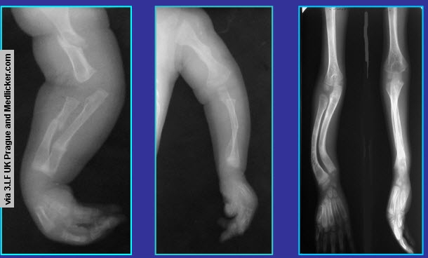 Figure 1 - Radiology