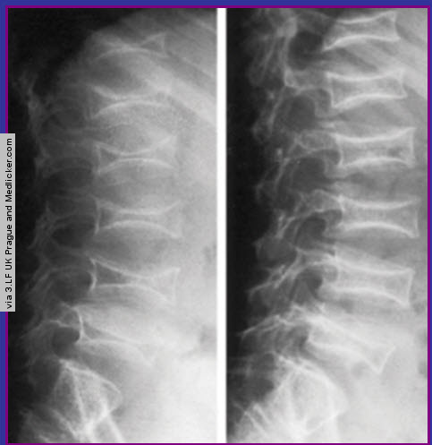 Figure 2 - Radiology