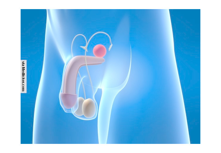 La prostatite: causes, symptômes, diagnostic et traitements