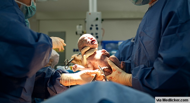 Dítě narozené císařským řezem