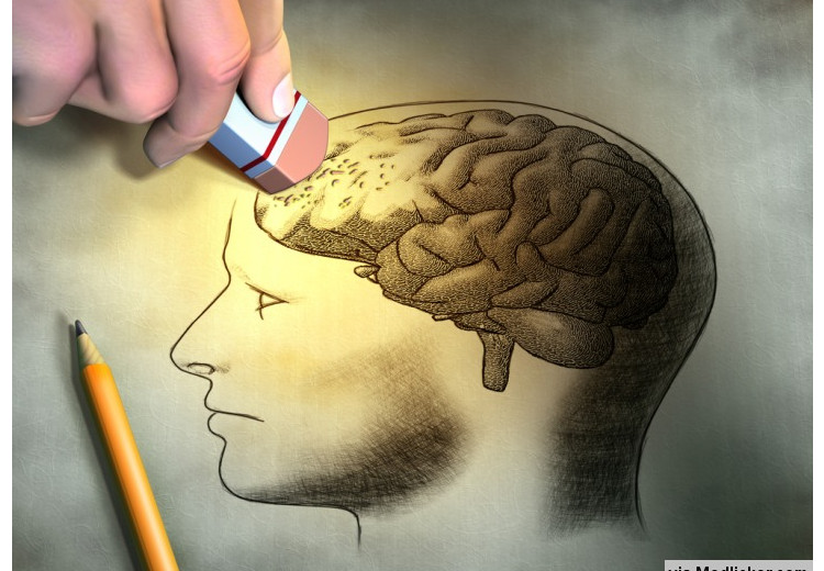 11 médicaments qui peuvent causer des pertes de mémoire