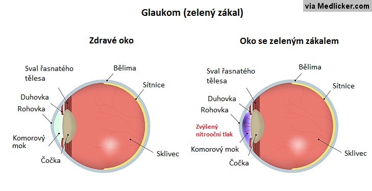 szempróba állvány diólevél tea szemre