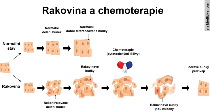 Jak působí cytostatika (cytotoxické léky) na buňku při chemoterapii?