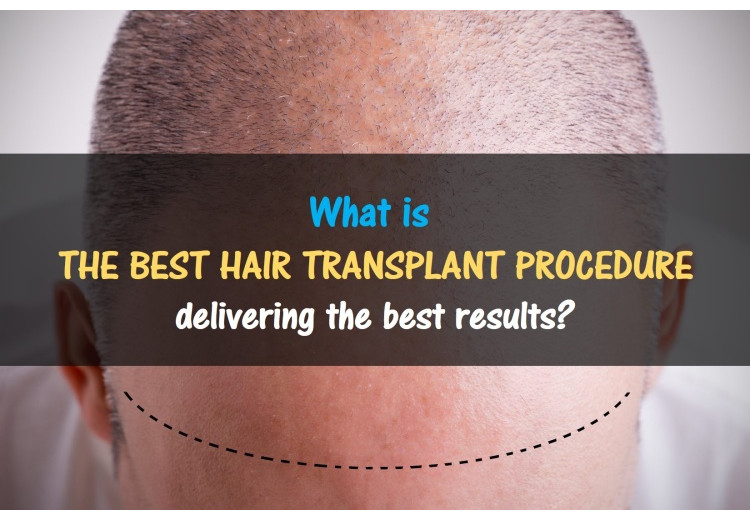 What Is The Best Hair Transplant Procedure?