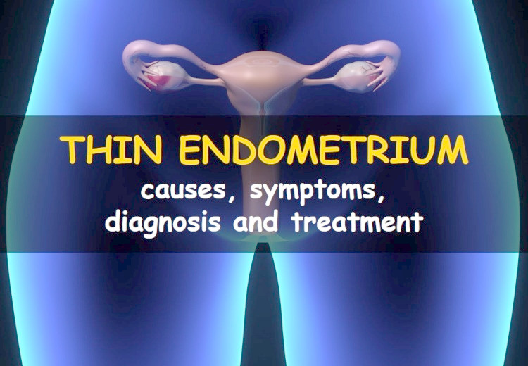 Thin endometrial lining: causes, symptoms, diagnosis and treatment