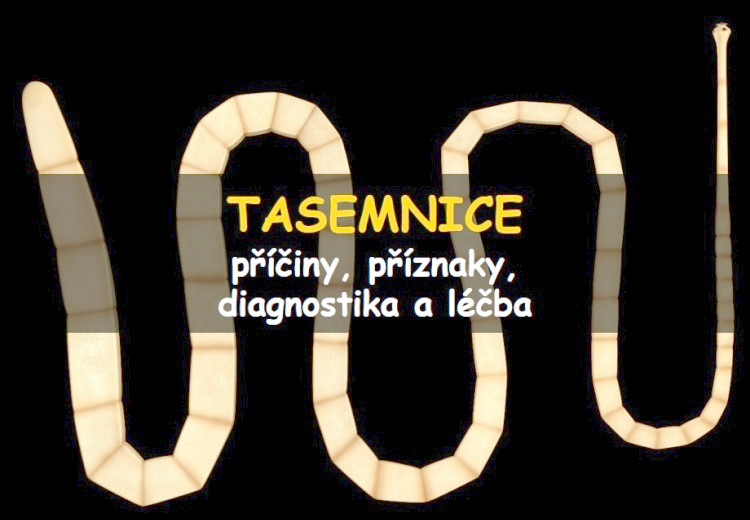 Tasemnice (tenióza)