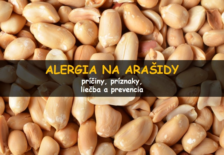 Alergia na arašidy