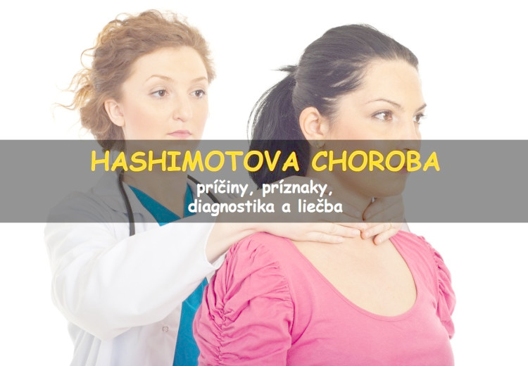 Hashimotova choroba (tyreoiditída)