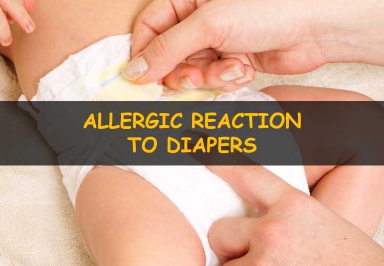 Allergic reaction to diapers