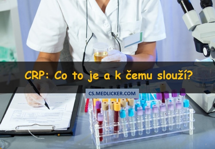 Diagnostický test CRP: co to je a k čemu slouží