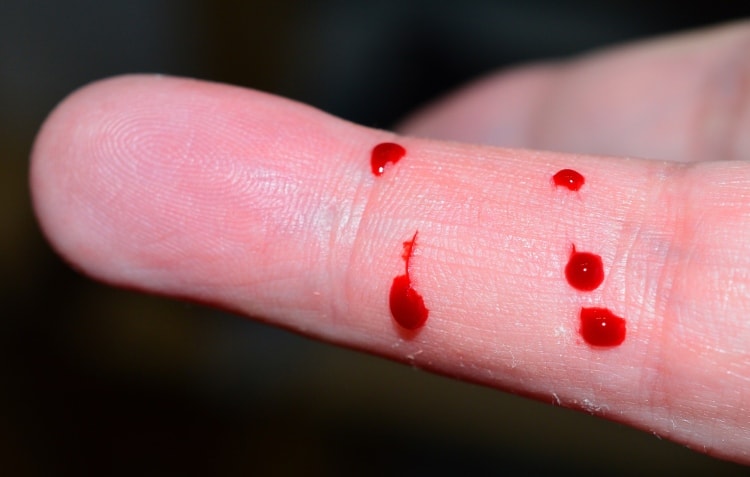 bleeding finger