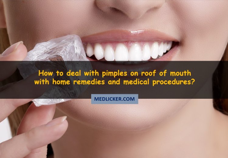 pimples-on-roof-of-mouth-causes-symptoms-and-treatment-options