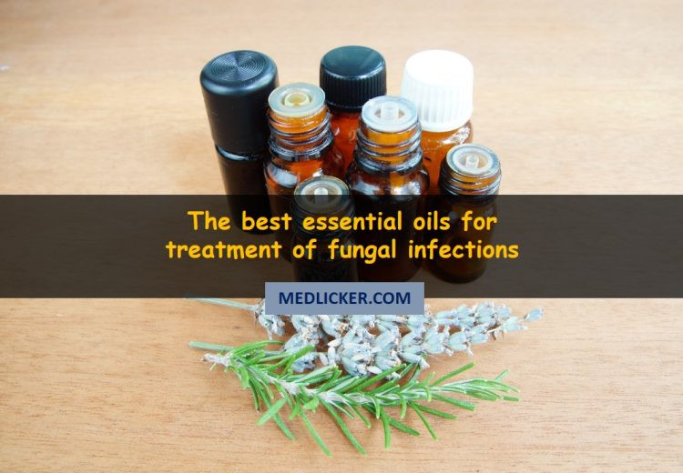 10 amazing essential oils to cure fungal infections