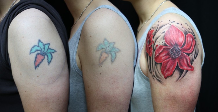 How To Treat An Infected Tattoo And Tattoo Ink Allergy