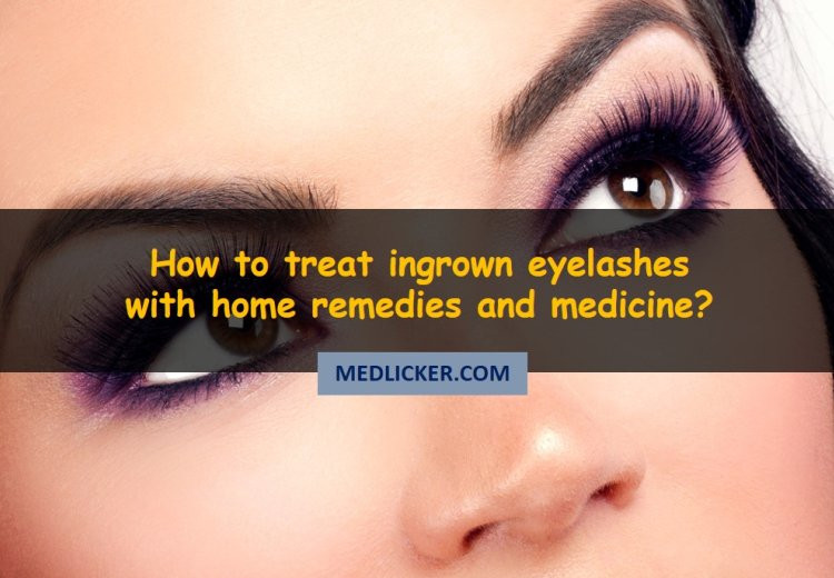 How to deal with ingrown eyelashes (trichiasis)?