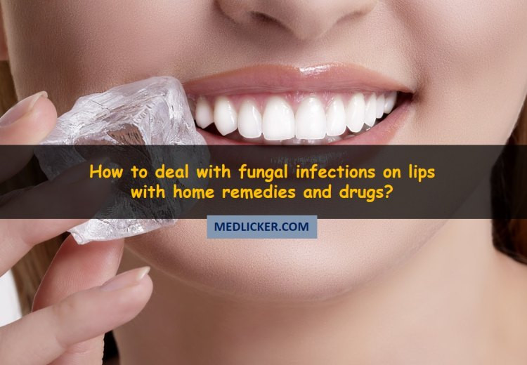 How to cure fungal infections on your lips with medicines and home remedies?