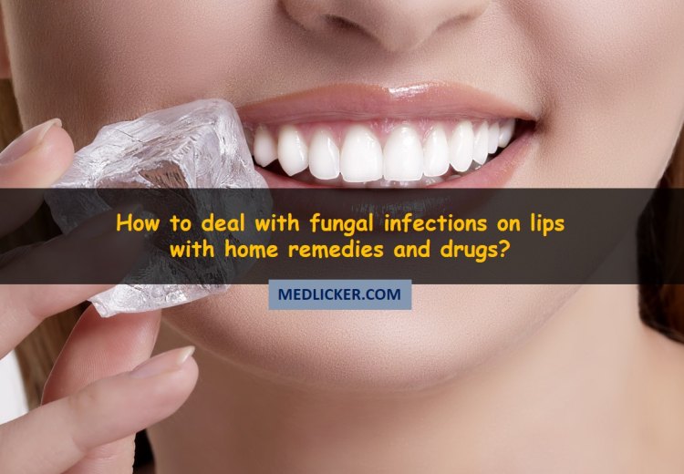 oral fungus treatment