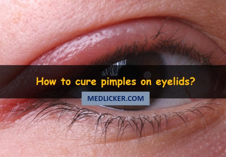How to cure pimples on eyelids with medicines and home remedies?