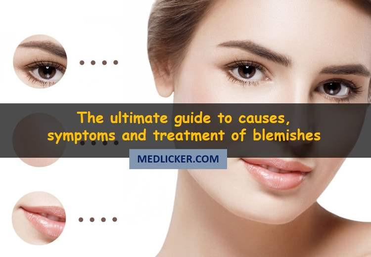 How to get rid of blemishes? The complete guide to types, causes and removal of discolored marks on skin
