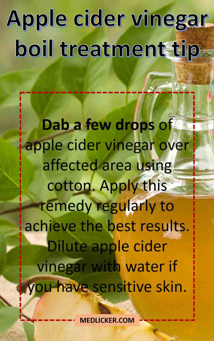Apple Cider Vinegar Boil Treatment Tip