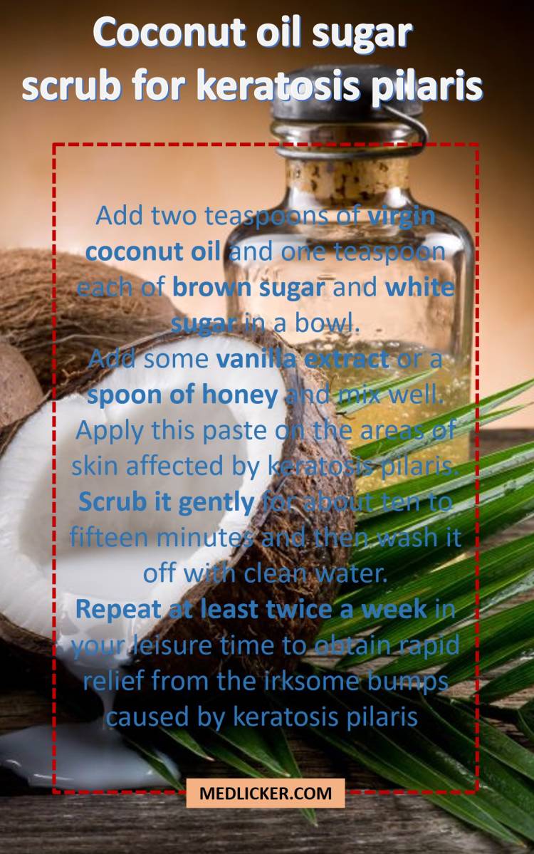 Coconut oil and sugar scrub for keratosis pilaris