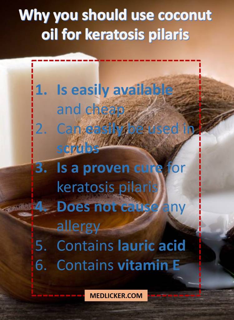 Why is coconut oil beneficial in treatment of keratosis pilaris?