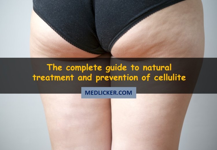 How to get rid of cellulite naturally?