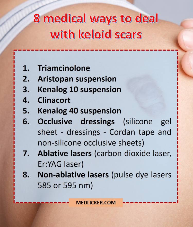 Medical treatment options for keloids (drugs and lasers)
