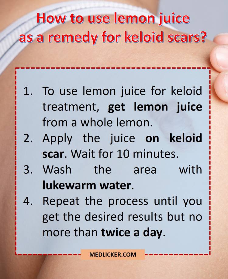How to use lemon juice as a remedy for keloids?