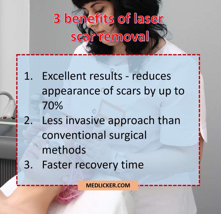 Benefits of laser scar removal