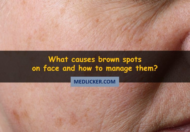 How To Remove Brown Spots From Your Face?