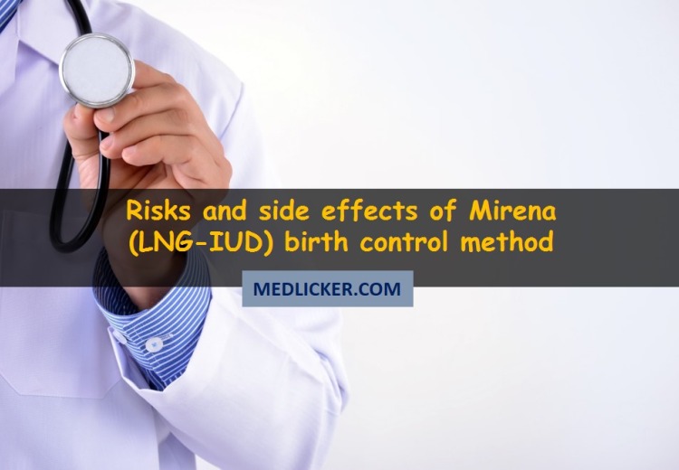 Mirena IUD side effects: the ultimate guide
