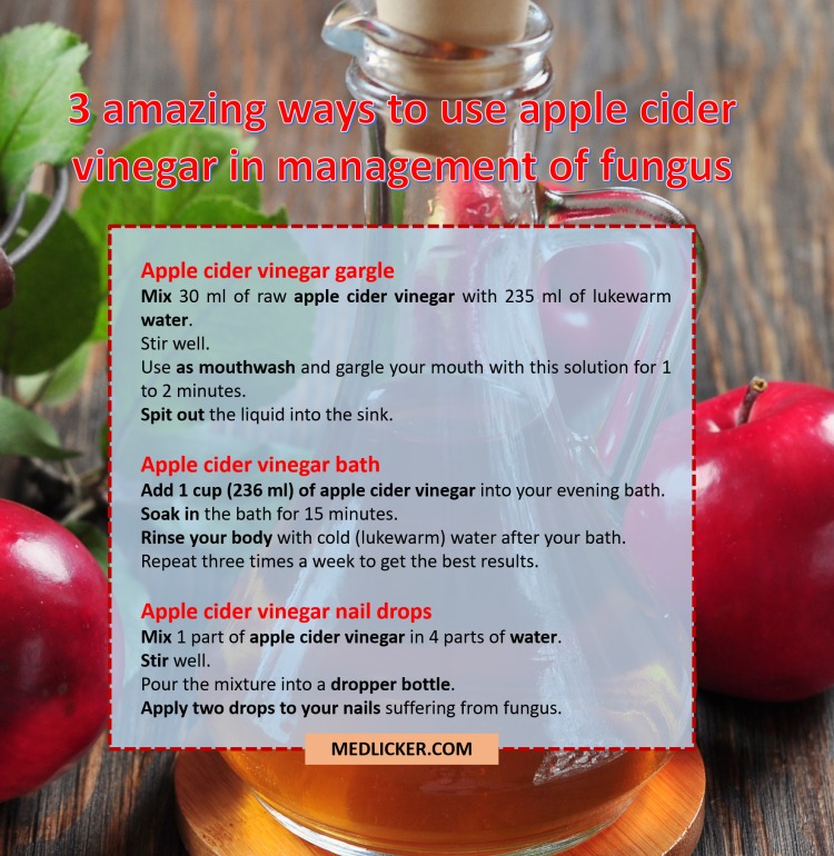 Three ways to use apple cider vinegar in treatment of mycoses