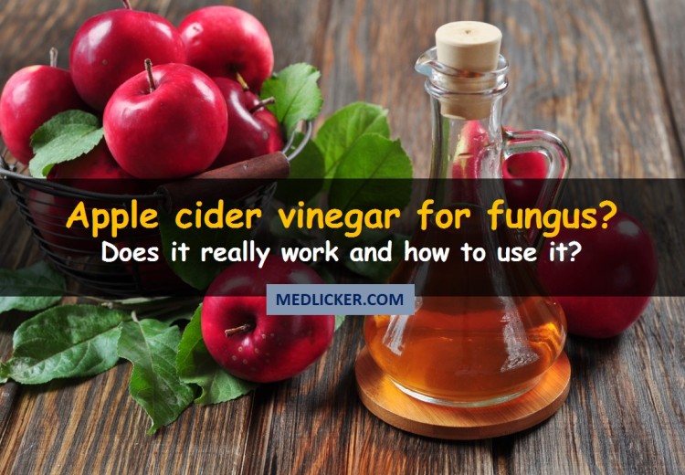 How to Use Apple Cider Vinegar in Treatment of Fungal Infections?