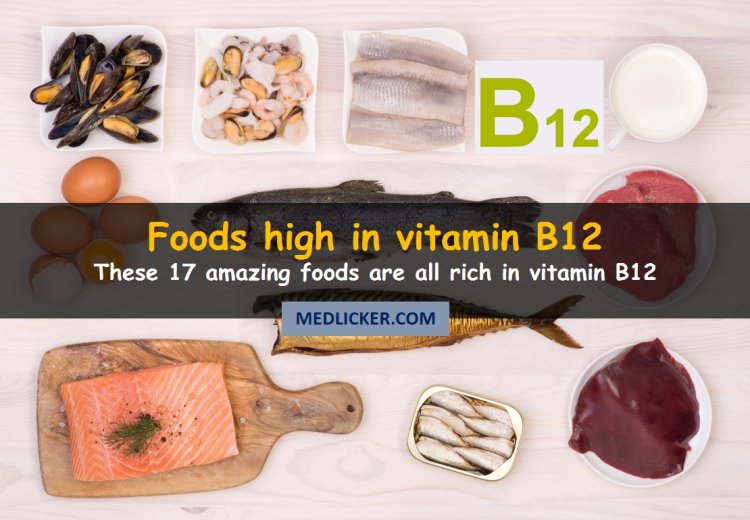 17 Foods High in Vitamin B12