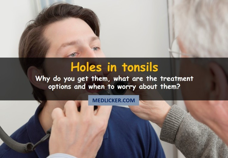 Holes in tonsils: definition, symptoms, treatment and prevention