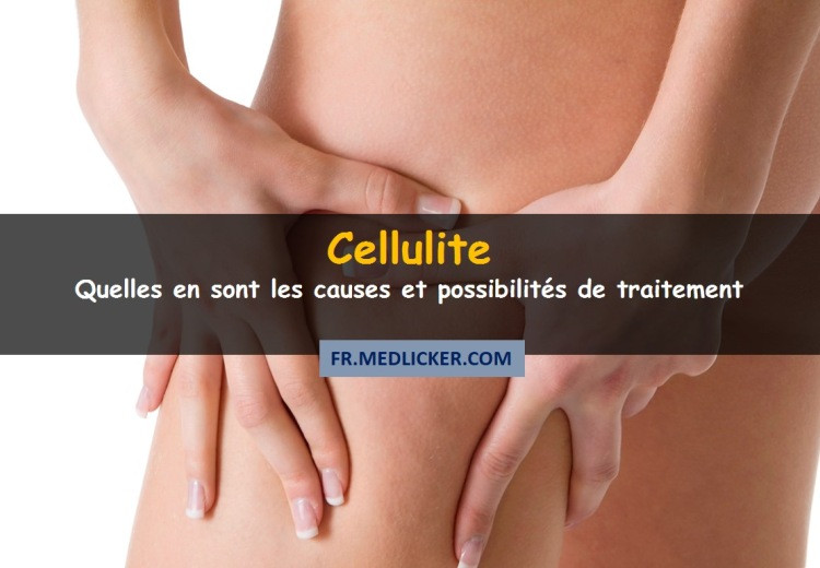 Cellulite: causes et traitements