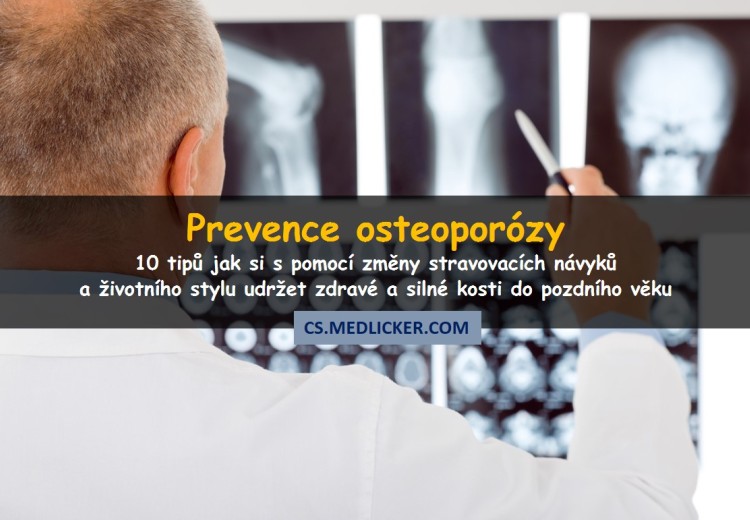 Prevence osteoporózy aneb jak si udržet silné a zdravé kosti do pozdního věku?