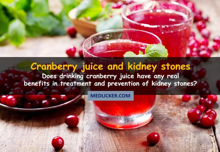 Is Drinking Cranberry Juice For Kidney Stones Any Good?