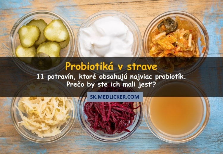 Aké sú najlepšie probiotické potraviny? Skúste tieto!